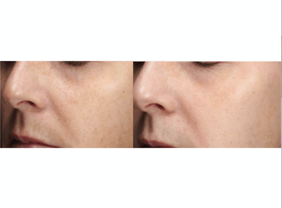 PCA Skin B3 brightening serum - Image 3
