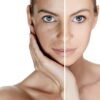 Profhilo Haenkenium® cream - Image 4