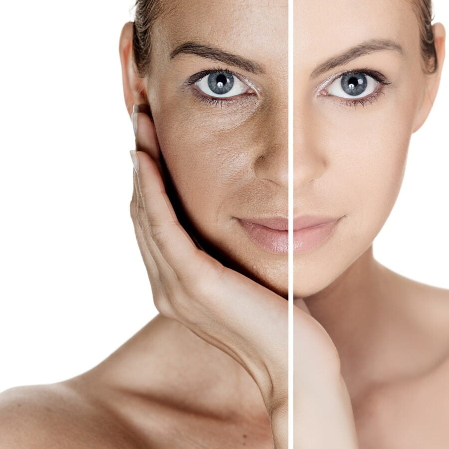 Profhilo Haenkenium® cream - Image 4