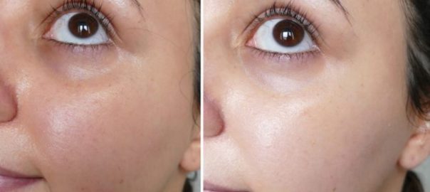 Skin Care
