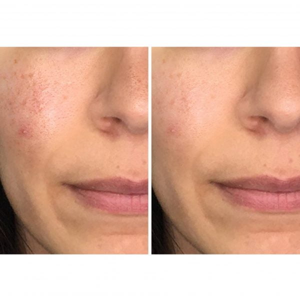 Masque-Peel-Off