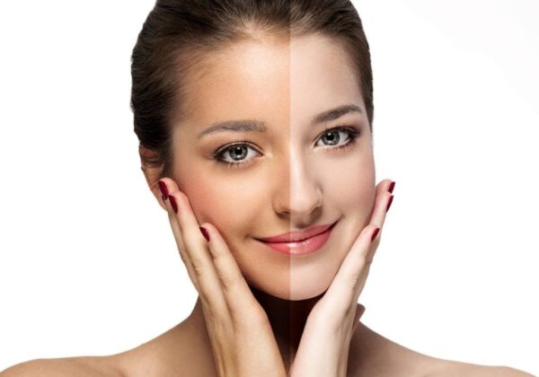 أكسدة البشرة